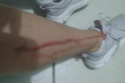 Vecinos de la Rogelio viven con miedo por ataques de perros callejeros