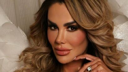 Salud de Ninel Conde: así fue su operación antes del reality