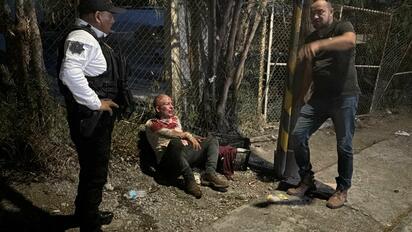 Fue al baño y terminó bañado en sangre tras brutal pelea en Monclova