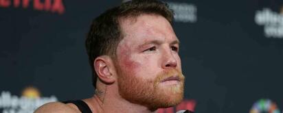 Contragolpe: Carta abierta a Canelo Álvarez 3.0