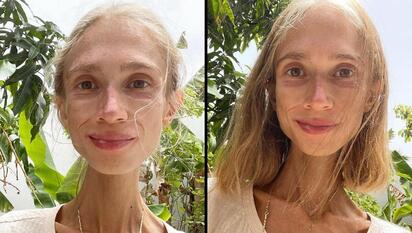 Muere Karolina Krzyzak en Bali tras severa malnutrición a los 27 años