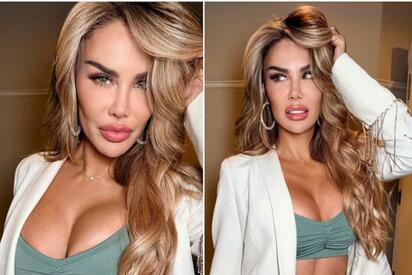 Ninel Conde cambia el color de sus ojos con cirugía