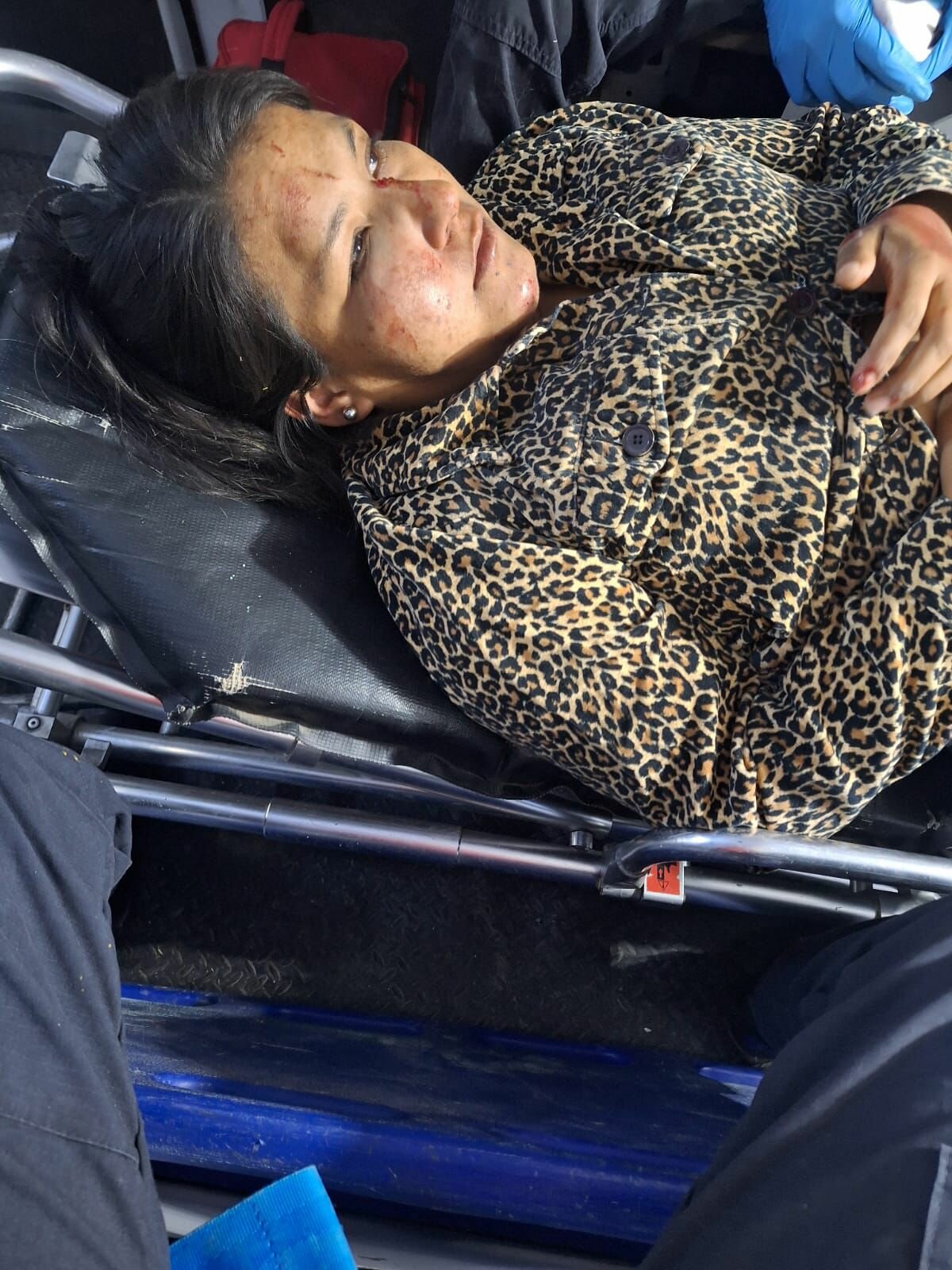 Mujer resulta atropellada durante feroz riña en la colonia 21 de Marzo