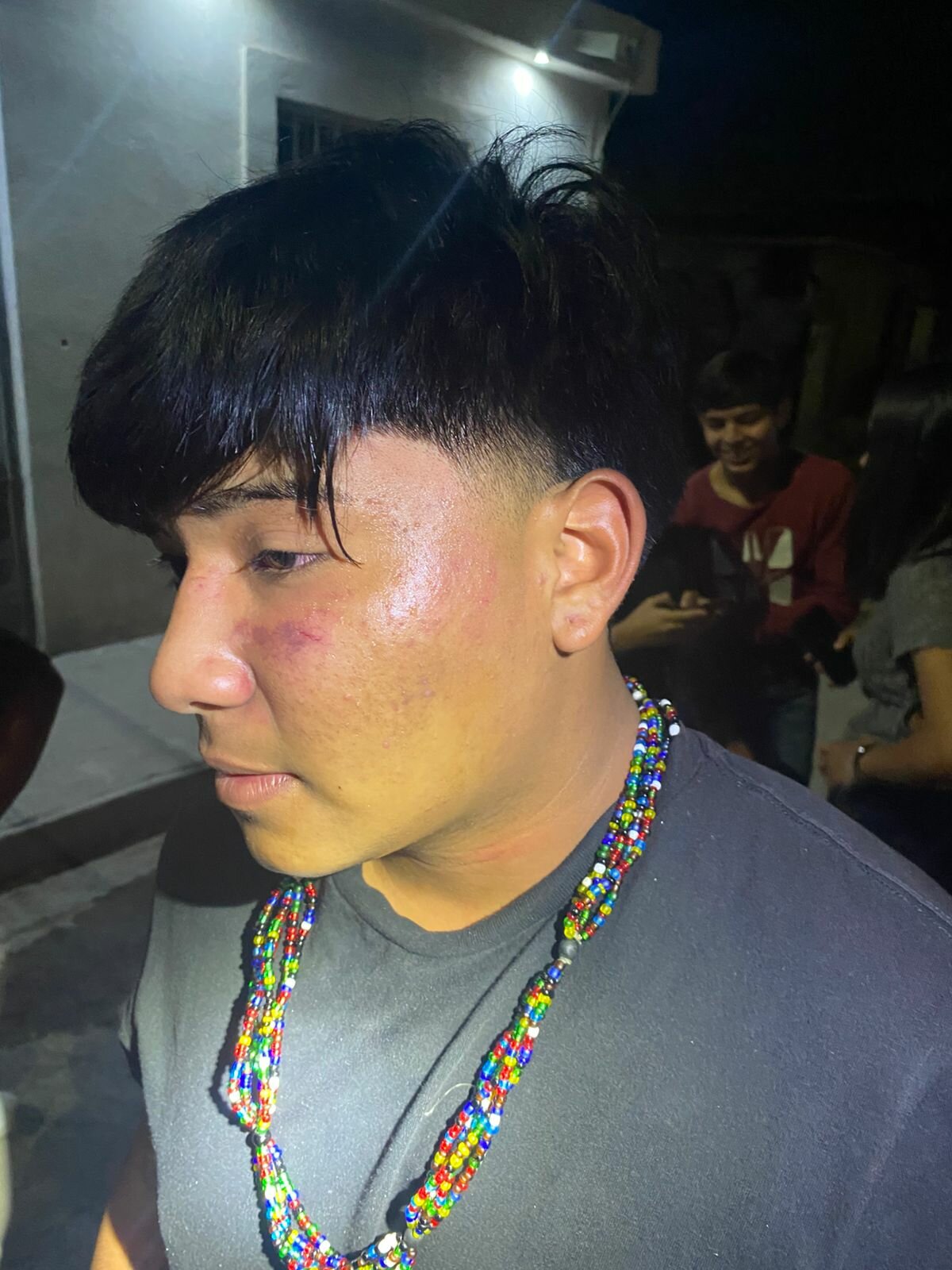 'Lagartones' abusivos golpean a jovencito