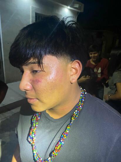 'Lagartones' abusivos golpean a jovencito