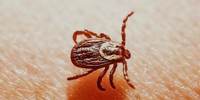Reportan cuatro posibles casos de rickettsiosis en Tamaulipas