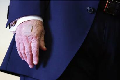Trump atribuye a la aspirina los moretones en sus manos