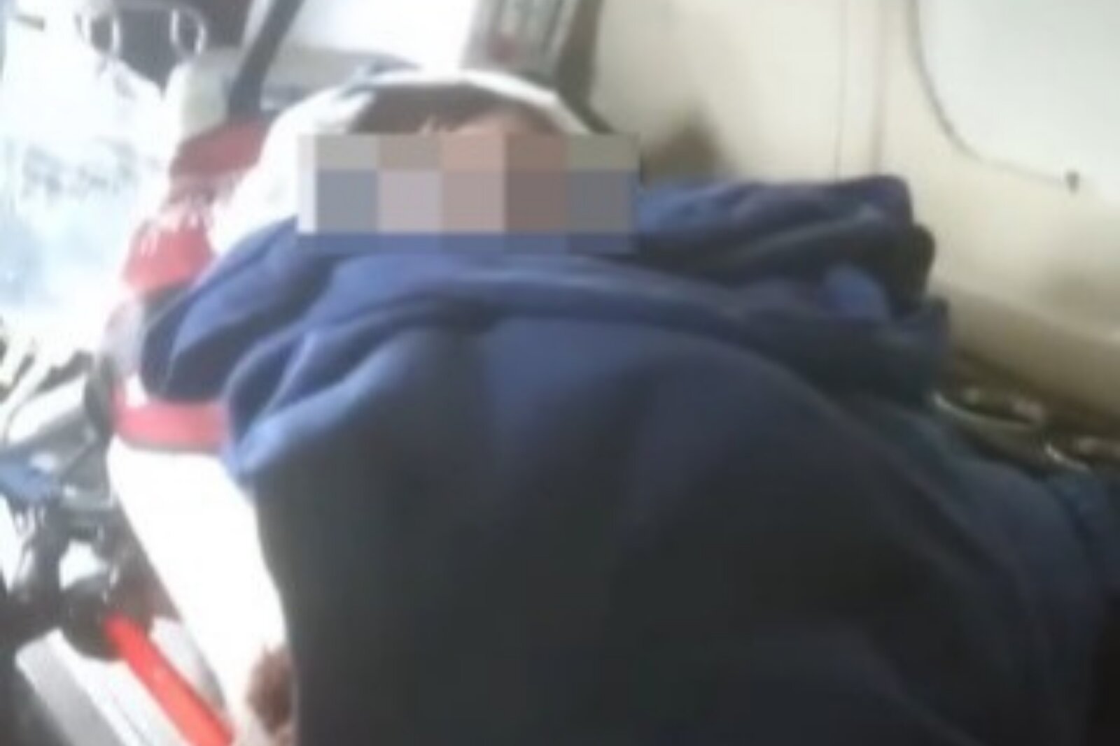 Esperanza y angustia tras injertos de piel a la bebé Margarita Rubí