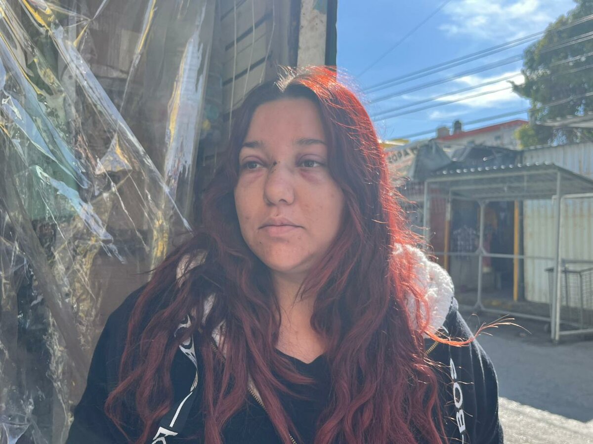 Mujer que sufrió agresión violenta en el Centro de Monclova expone clima de temor