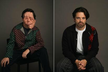 2026 Oscar: ¿Qué es la neurofibromatosis? La enfermedad que padece el actor Adam Pearson