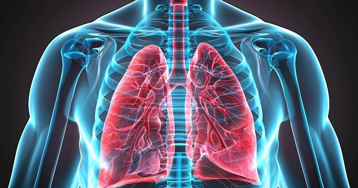 Síntomas que pueden anticipar la fibrosis pulmonar idiopática antes del diagnóstico
