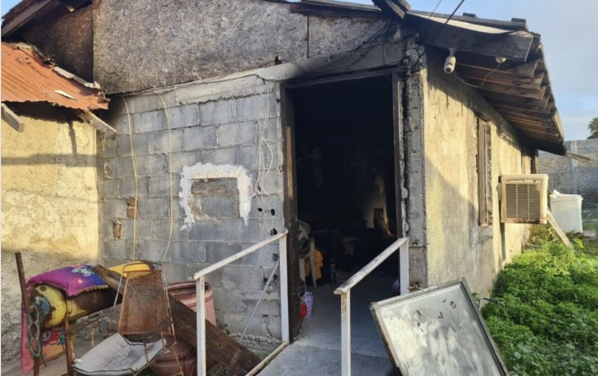 Incendio en vivienda deja mujer lesionada en la colonia Mundo Nuevo