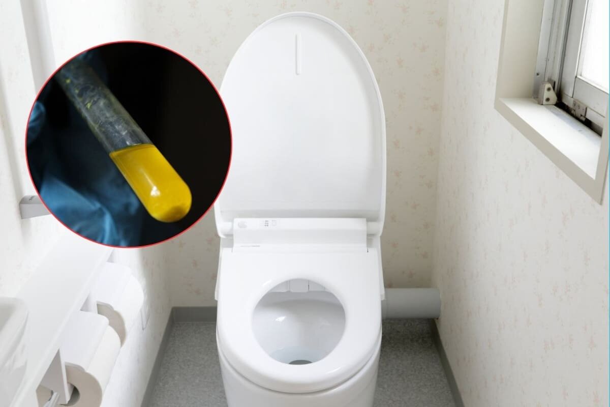 Cambios en la orina que advierten problemas renales que muchos ignoran