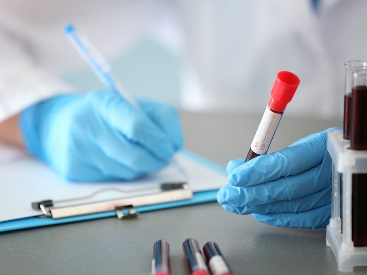 La mayoría de la gente se haría un análisis de sangre para Alzheimer