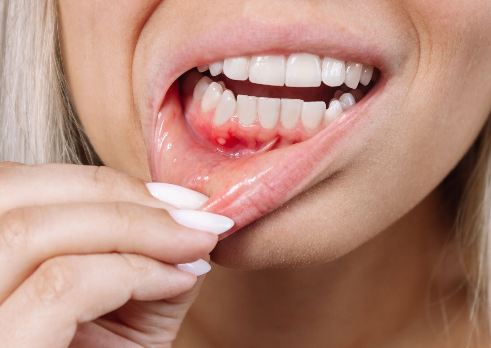 Señales de alerta en la boca que pueden indicar enfermedades graves