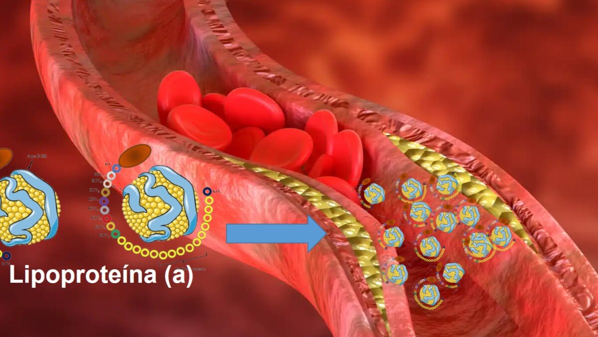 Evidencia actual y desafíos clínicos en el manejo de la lipoproteína