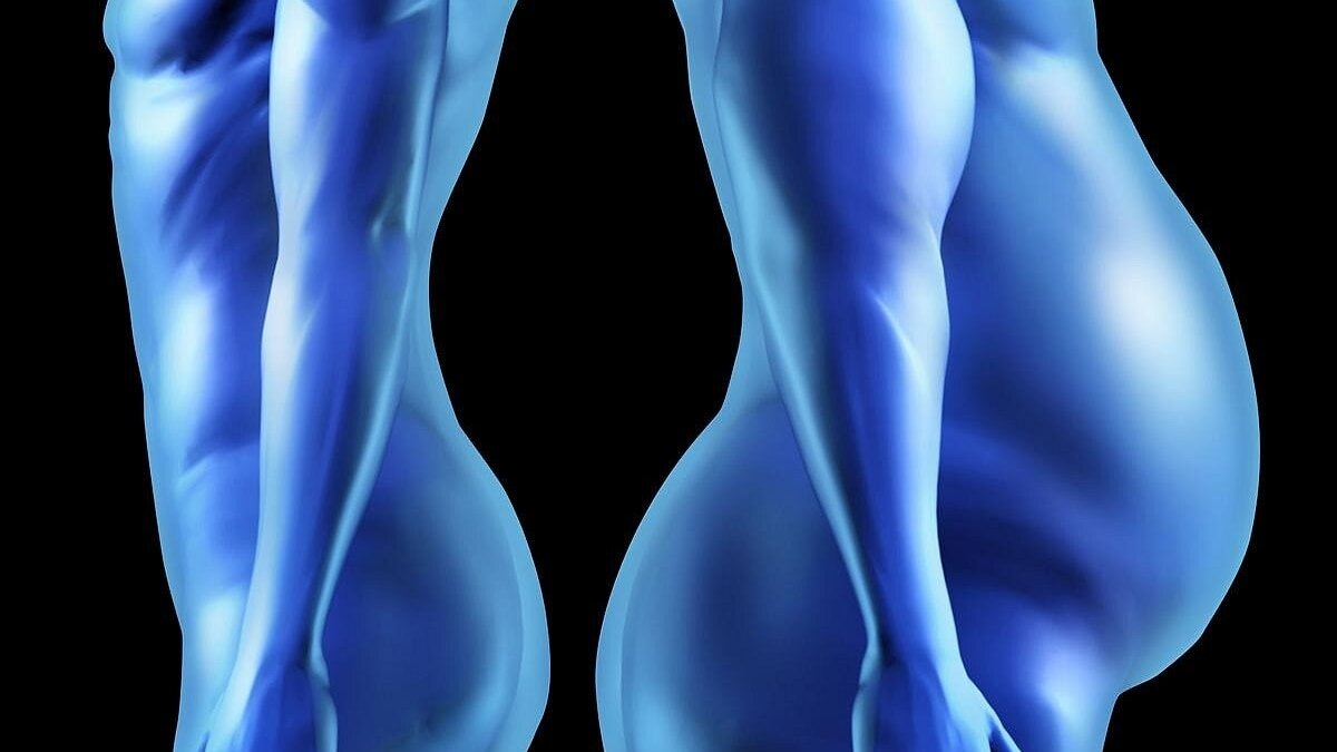 Grasa abdominal oculta vinculada al control de la vejiga en mujeres