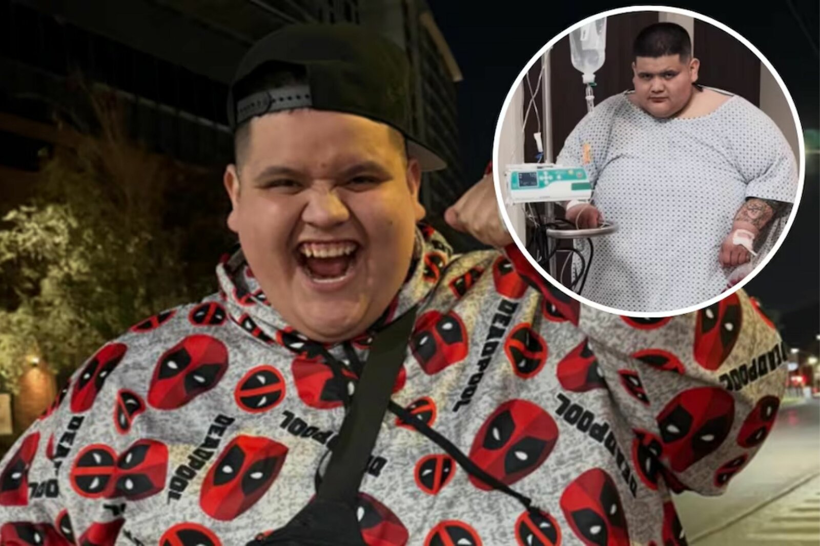 Óscar Espinoza “Baby Face”, influencer de La Marraniza, es hospitalizado