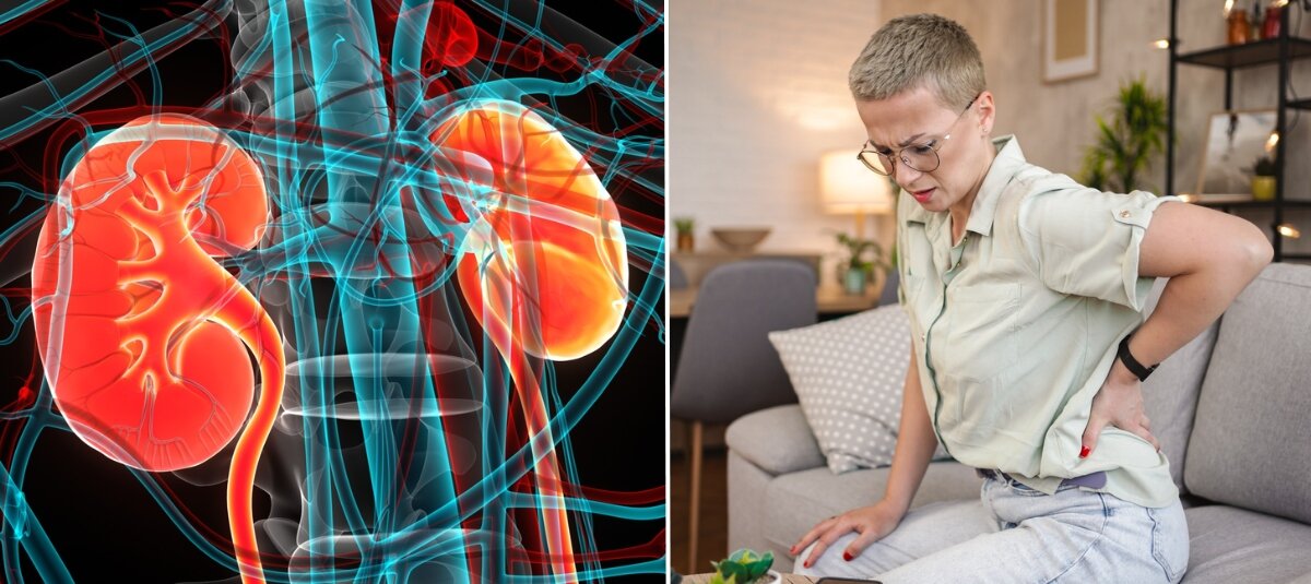 Los síntomas más comunes del cáncer de riñón que muchos ignoran