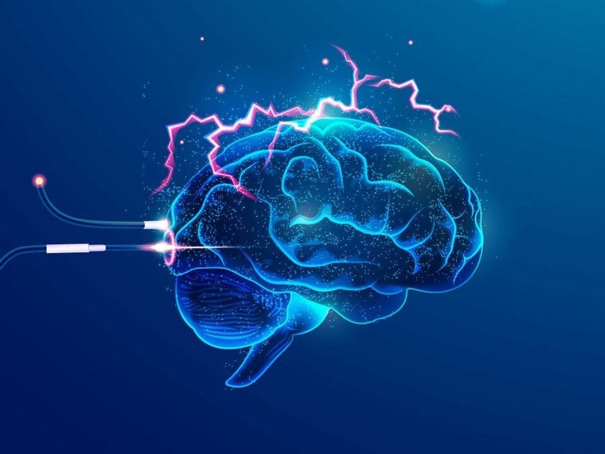 Los impactos en la cabeza pueden alterar la salud intestinal incluso sin conmoción cerebral