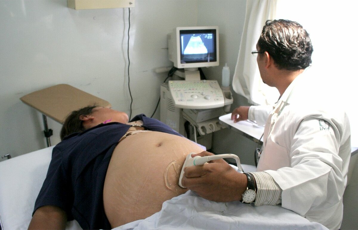 IMSS