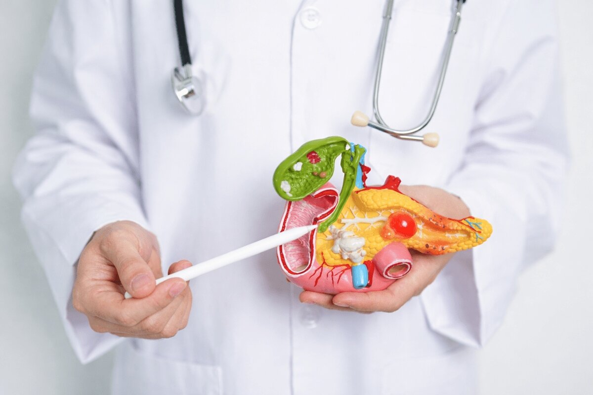 Las señales tardías del cáncer de páncreas que muchas personas ignoran