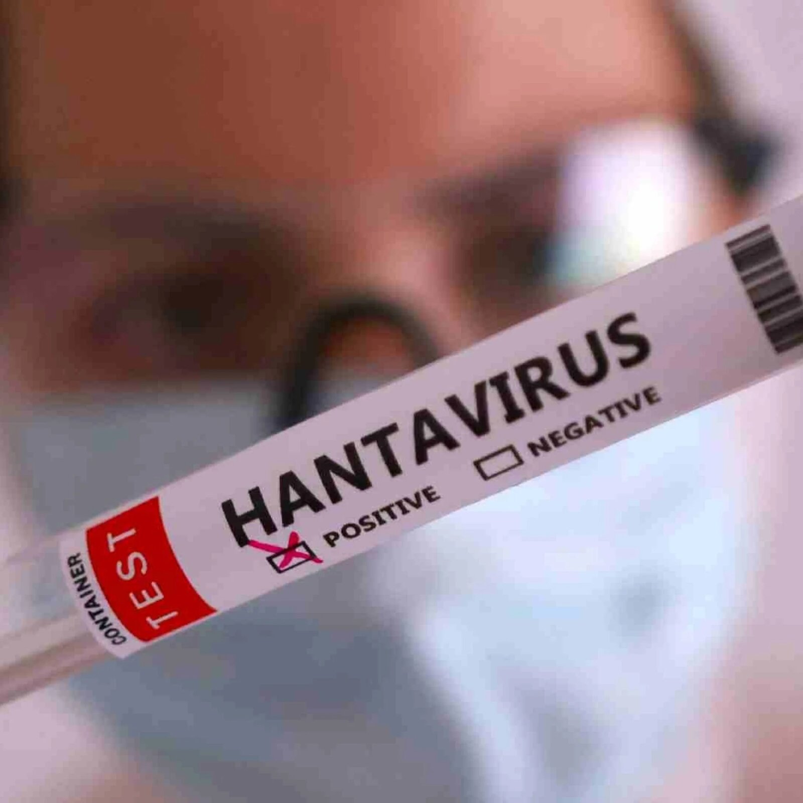 México activa alerta sanitaria por brote de hantavirus 