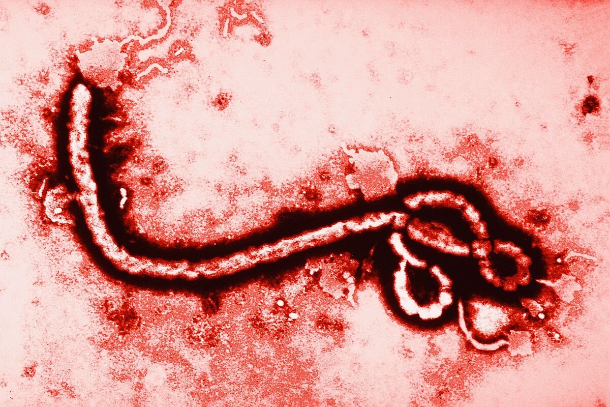 Ébola: por qué es uno de los virus más letales del mundo