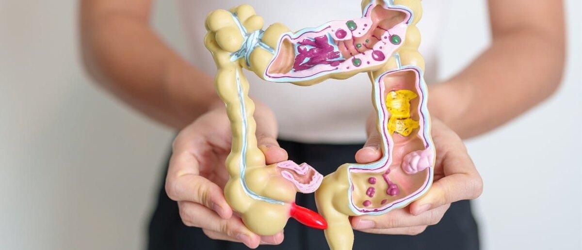 Síntomas de Enfermedad Inflamatoria Intestinal y qué tan peligrosa es
