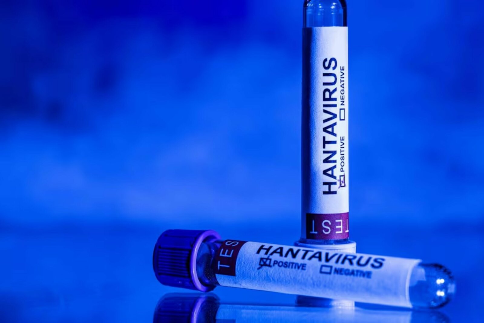 Confirman caso de hantavirus en pasajero del crucero Hondius aislado en Madrid