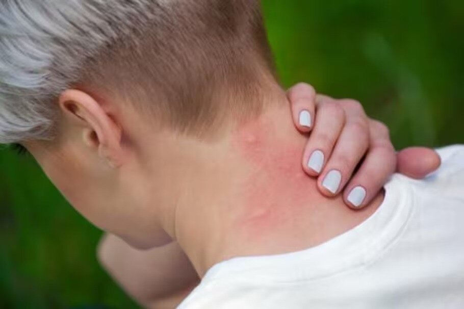 Llaman a eliminar criaderos de mosquitos tras recientes lluvias en Piedras Negras