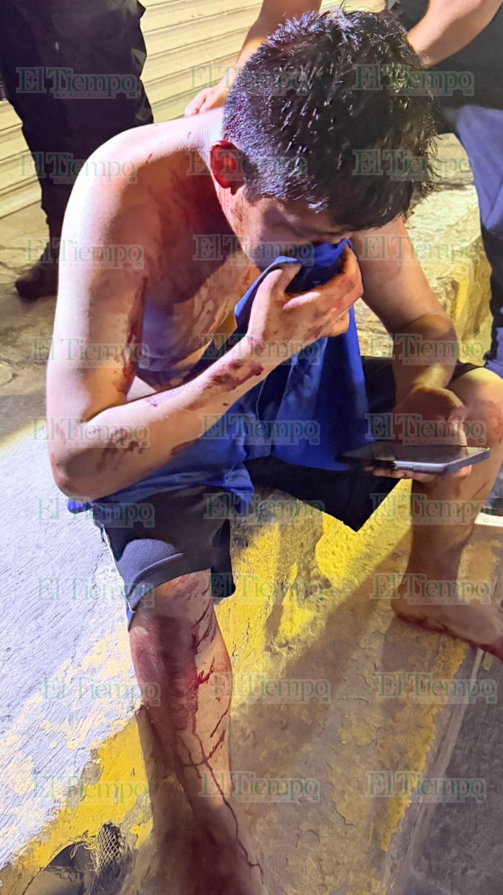 Celos desatan ataque con cuchillo; taquero termina hospitalizado y agresor es detenido 