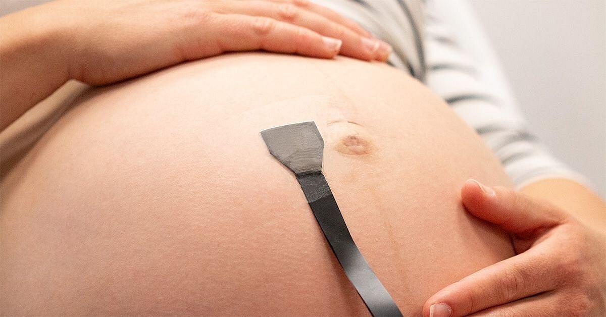Un innovador parche de ultrasonido podría convertirse en una herramienta valiosa para proteger embarazos de alto riesgo, ya que permite vigilar de forma