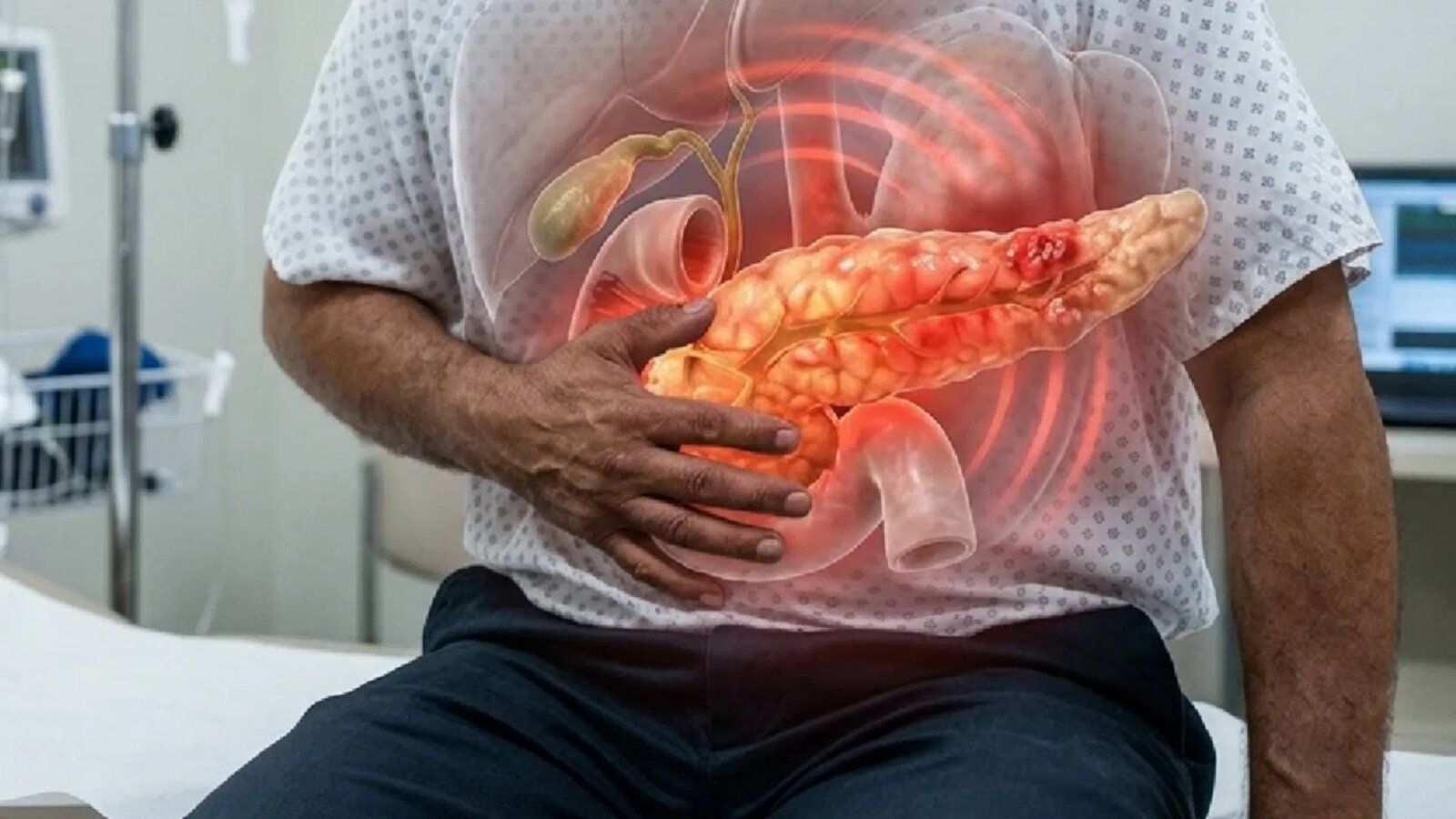 Nueva píldora contra el cáncer de páncreas logra duplicar la supervivencia en pacientes avanzados