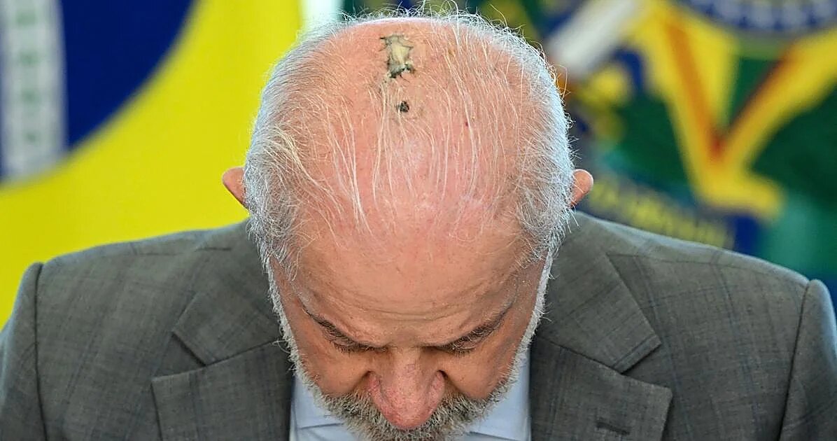 Lula anuncia que superó el cáncer de piel tras concluir radioterapia