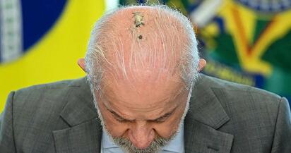 Lula anuncia que superó el cáncer de piel tras concluir radioterapia