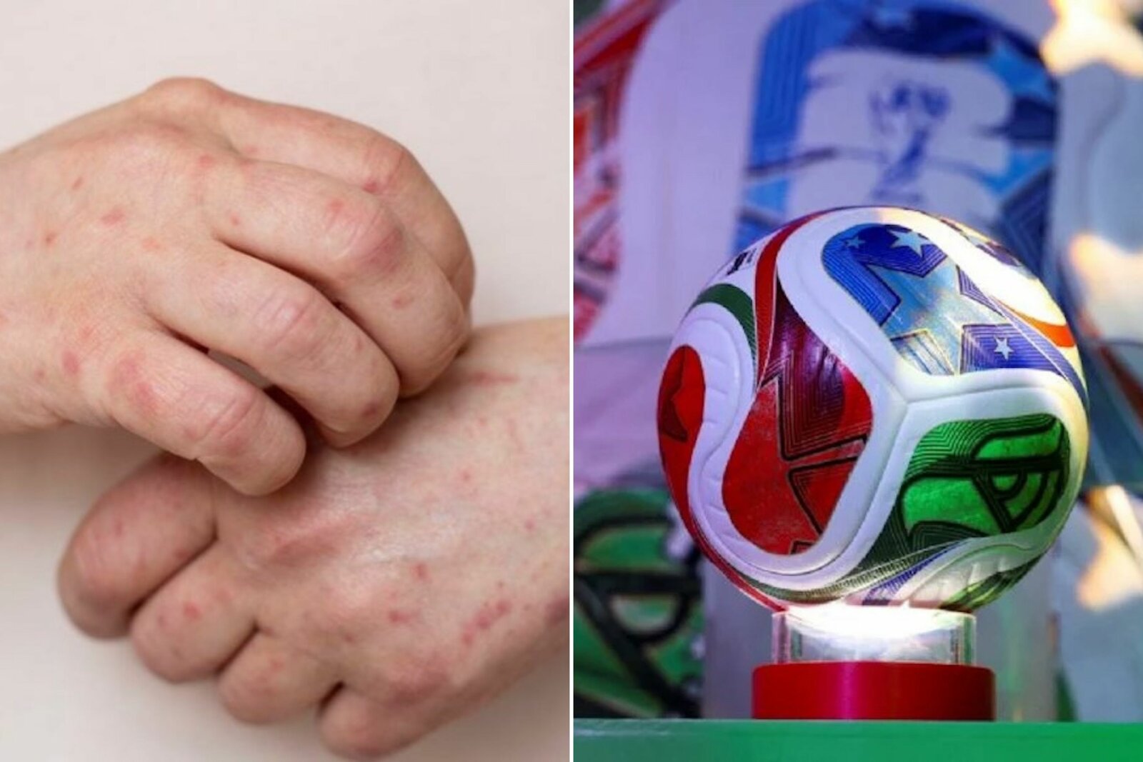 Especialistas advierten sobre enfermedades que podrían propagarse en el Mundial
