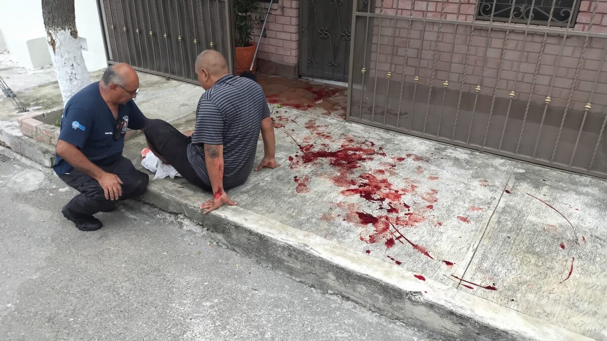 Trasladan a hospital a hombre herido por ataque canino