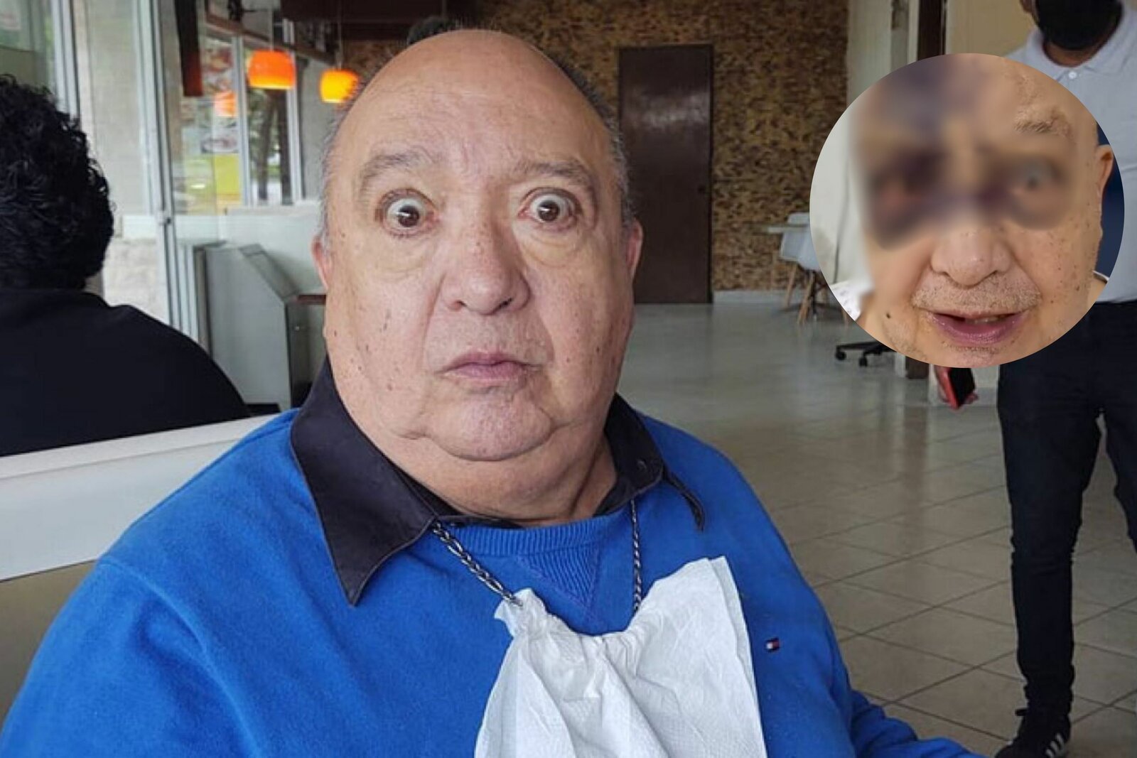 Luis de Alba sufre caída y aclara su estado de salud tras aparecer con hematomas