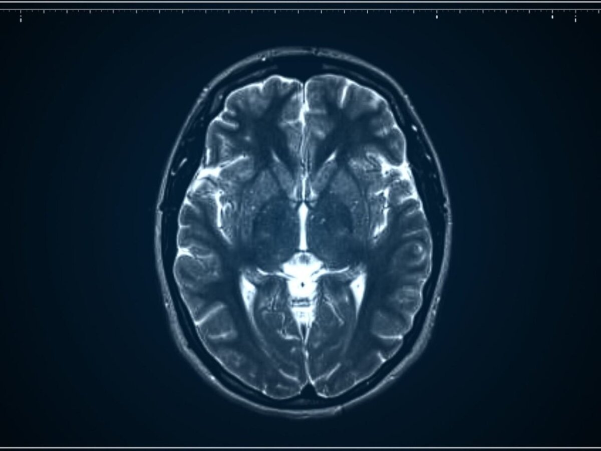 Anticonceptivo con estrógenos puede proteger el cerebro de las mujeres a medida que envejecen