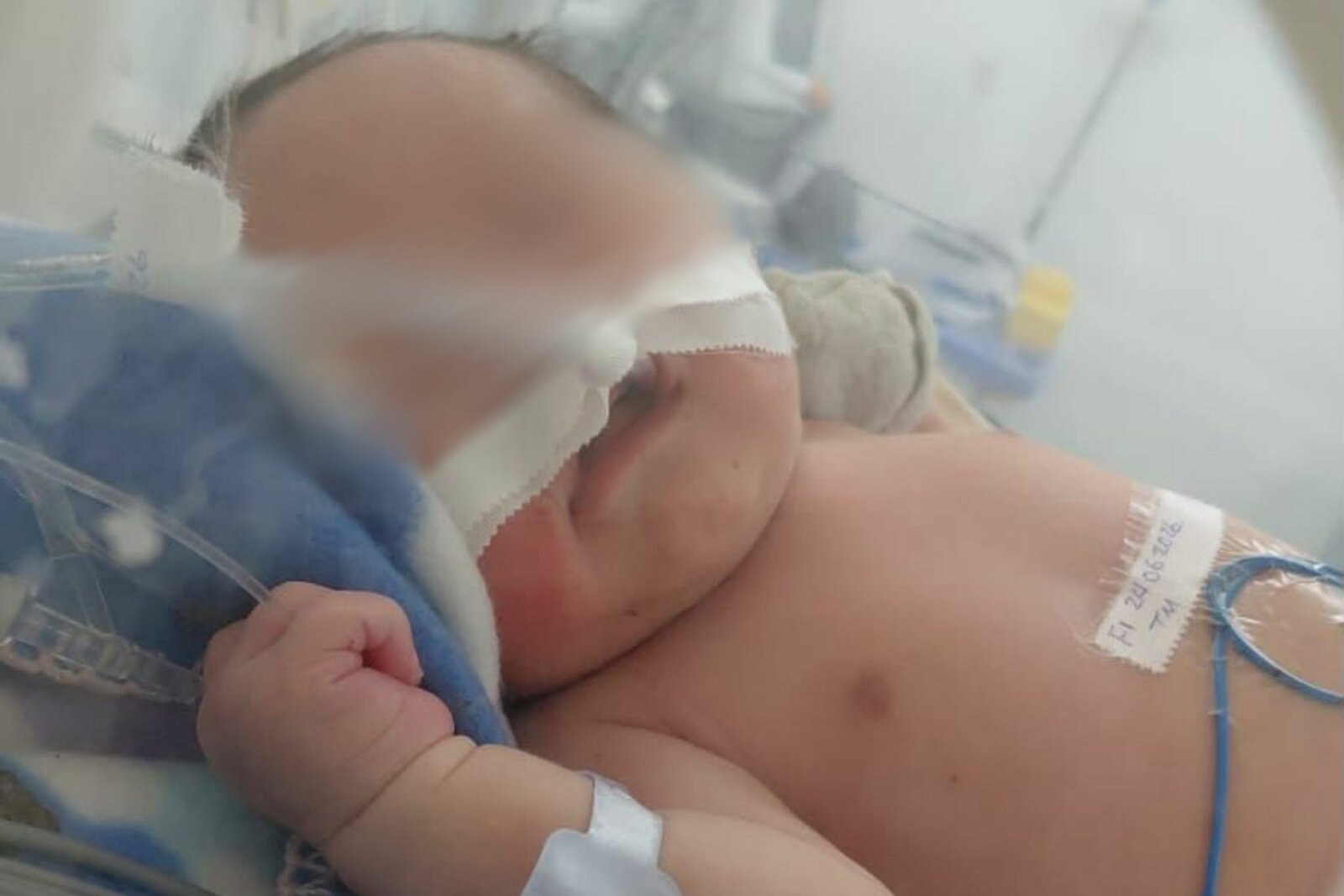 El tiempo se agota para Gabriel Enrique; familia clama por una cirugía que aún no llega para el recién nacido