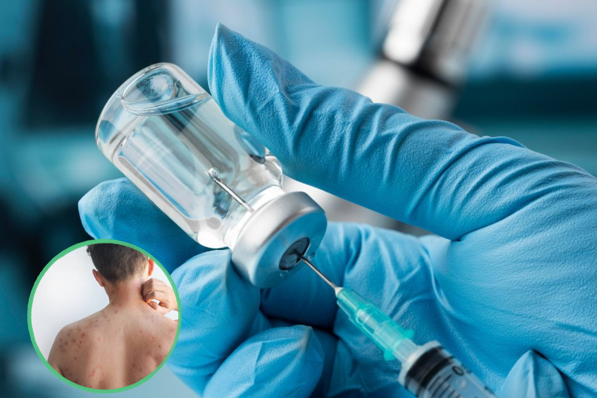 El sarampión sigue avanzando en México: Salud lanza nuevo llamado urgente a vacunarse