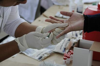 VIH en México: signos tempranos, transmisión y dónde hacer la prueba