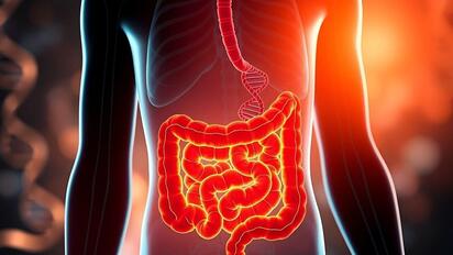 Los estadounidenses rurales son más propensos a ver el cáncer como una sentencia de muerte