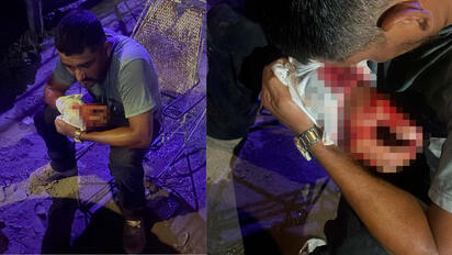 Emboscada deja un hombre apuñalado y otro lesionado en la colonia Pípila
