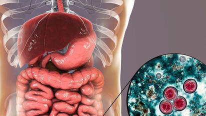 Cyclospora: qué es, síntomas además de la diarrea repentina y cómo se transmite