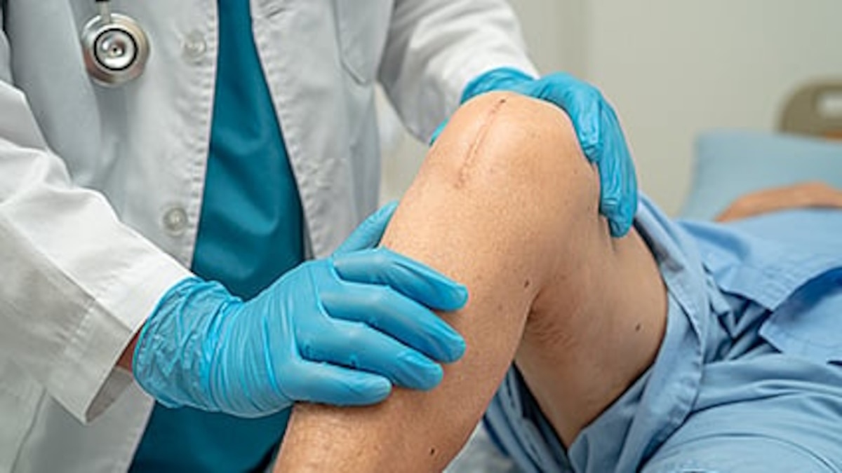 ¿Dolor de rodilla? Las investigaciones sugieren que la cirugía no es la mejor solución