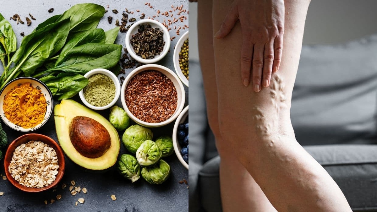 9 alimentos que ayudan a reducir la inflamación