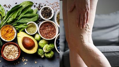 9 alimentos que ayudan a reducir la inflamación