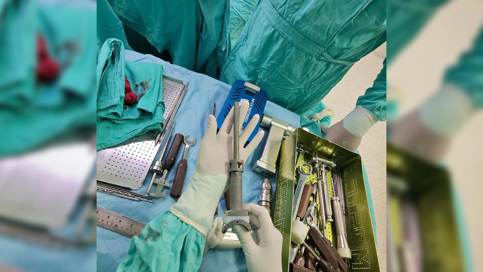 INCan: Cirugía de alta complejidad permite evitar amputación a paciente con cáncer de tobillo